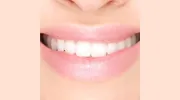 Family Dental Rego Park