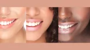 Watergate Dental