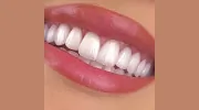 Central Florida Cosmetic & Family Dentistry