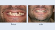 Smile Designers