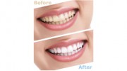Bridgepointe Dental Studio