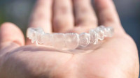 Invisalign