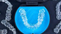 Invisalign