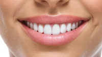 Cosmetic Dentistry