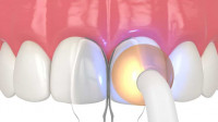 Cosmetic Dentistry