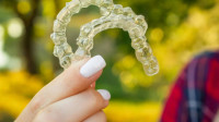 Invisalign