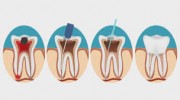 Hillcrest Endodontics