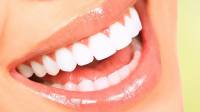 Cosmetic crowns and veneers