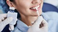 Teeth Whitening in Beverly Hills, CA