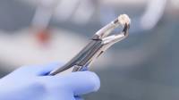 Teeth Extraction