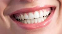 Cosmetic Periodontal Surgery