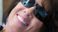 Prophylaxis (Teeth Cleaning)