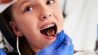 Early Orthodontics