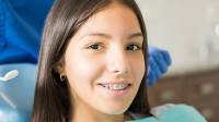 Dental Braces