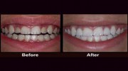 Barksdale Family Dentistry