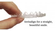Invisalign