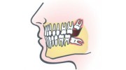 Wisdom Teeth Extraction