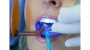 Teeth Whitening