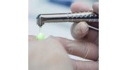 Laser Dentistry