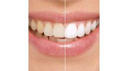 Teeth Whitening