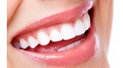 Dental Fillings