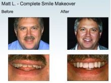 Northwood Dental Patient Smile Makeover Before/After Photos