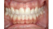 Cosmetic dentistry