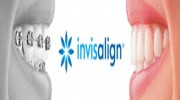 Invisalign®