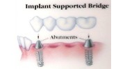 Bridges and Dentures