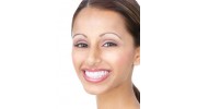 Porcelain Veneers